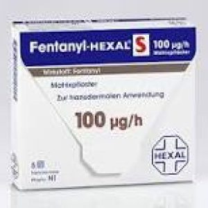 Fentanylpleister kopen